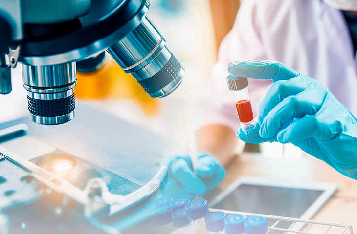 Detectan nueva variante del VIH más agresiva y contagiosa