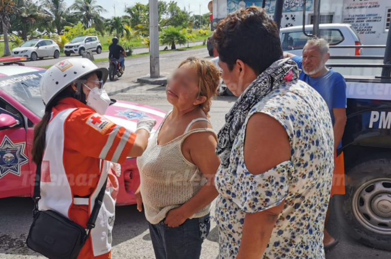 Hombre ataca a mordidas a su pareja en Ciudad del Carmen